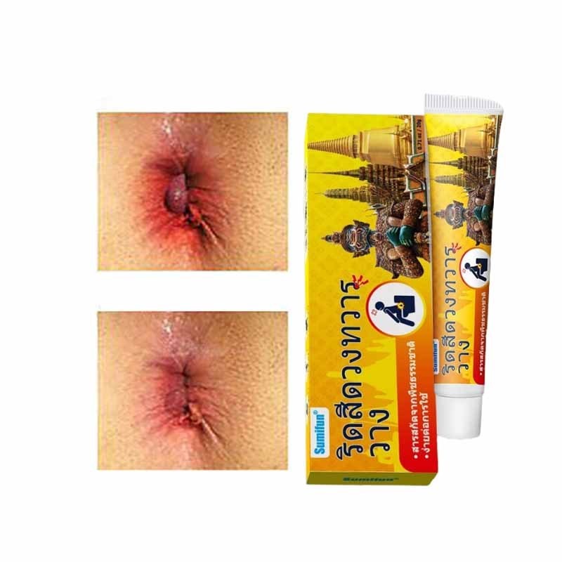 CODobat wasir salep ambeien paling ampuh orinal salep wasir Thailand Salep Krim Yang Ampuh Mengatasi