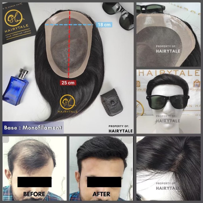 HOT SALE Toupee/tutup botak pria,warna natural 20cm, luas 25x18,100% Human Hair