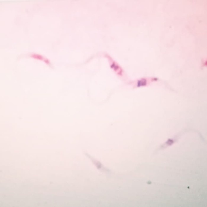 JTTOP" GIEMSA STAIN 100 ML