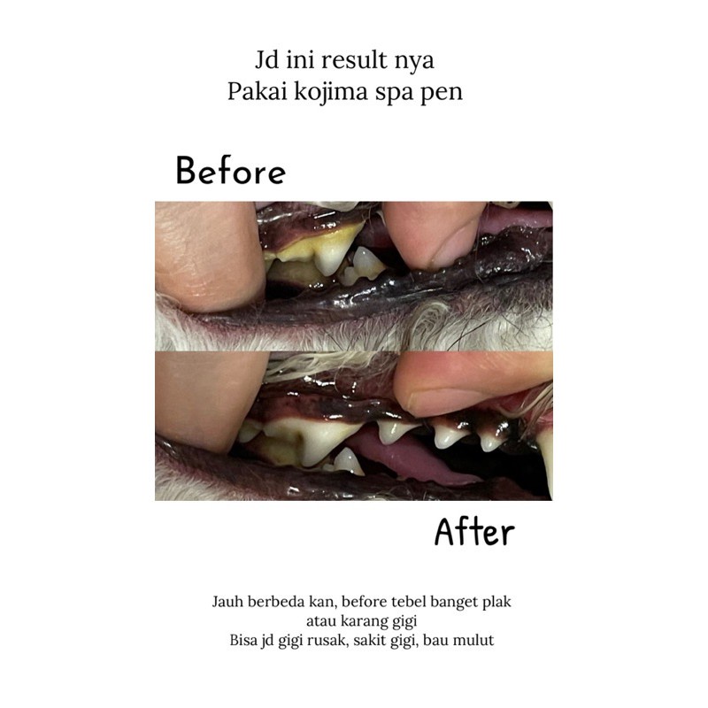 Ready Kojima japan teeth cleaning and spa pen (melembutkan karang gigi)