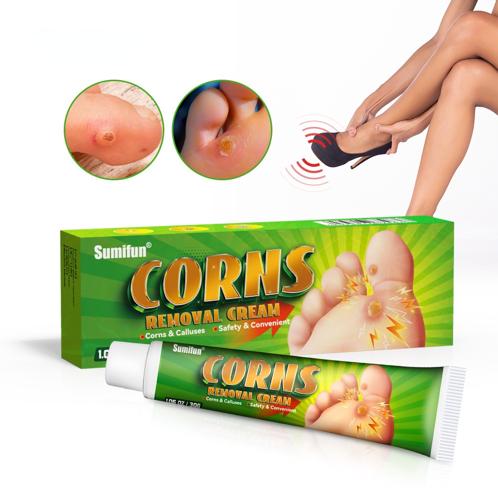 Foot Corn Remover Cream Chicken Eye Skin Infection Treatment Ointment Feet Dead Skin Calluses