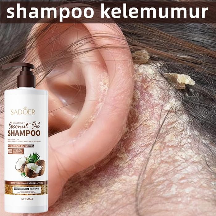 Obat Ketombe Rambut Rontok Shampo ketombe Obat Ketombe Rambut Rontok Berkerak Sampo 500ML Singkirkan