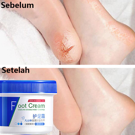 MD Vaseline Kaki Pecah Dan Kering Foot Cream Obat Kaki Pecah Pelembab Kaki Kering Dan Pecah