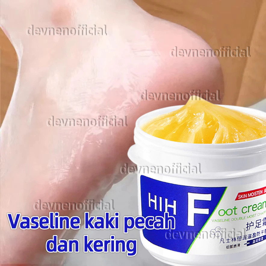 MD Vaseline Kaki Pecah Dan Kering Foot Cream Obat Kaki Pecah Pelembab Kaki Kering Dan Pecah