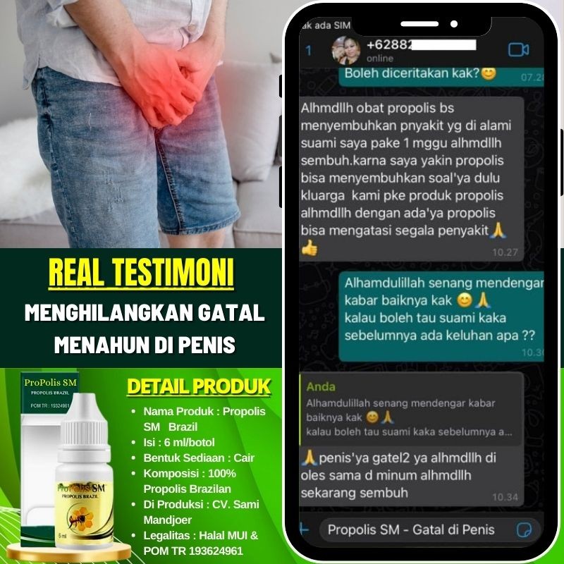 Obat Oles Sariawan di Penis Kemaluan, Obat Pengering Luka di Kemaluan Pria, Obat Penis Lecet Berair,