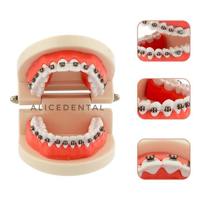 Alice Dental Model Studi Ortho Study Phantom Gigi Typodont Orthodontic