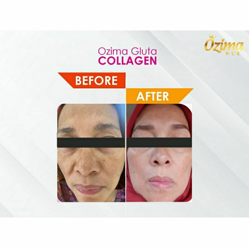 Ozima Drink Minuman Pencerah Kulit