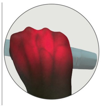 Vein finder/ vein viewer/ alat pencari vena