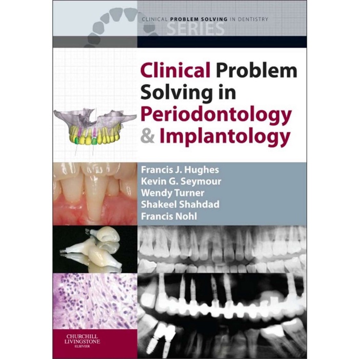 Buku Clinical Problem Solving In Periodontology Implantology Softcover