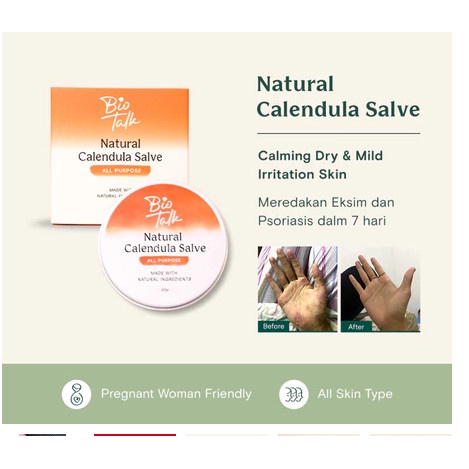 BIOTALK CALENDULA SALVE ASLI HARGA GROSIRAN