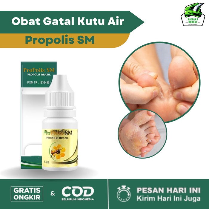 Terlaris Obat Kutu Air, Kutu Air Di Kaki, Kutu Air Di Sela Jari Propolis Sm