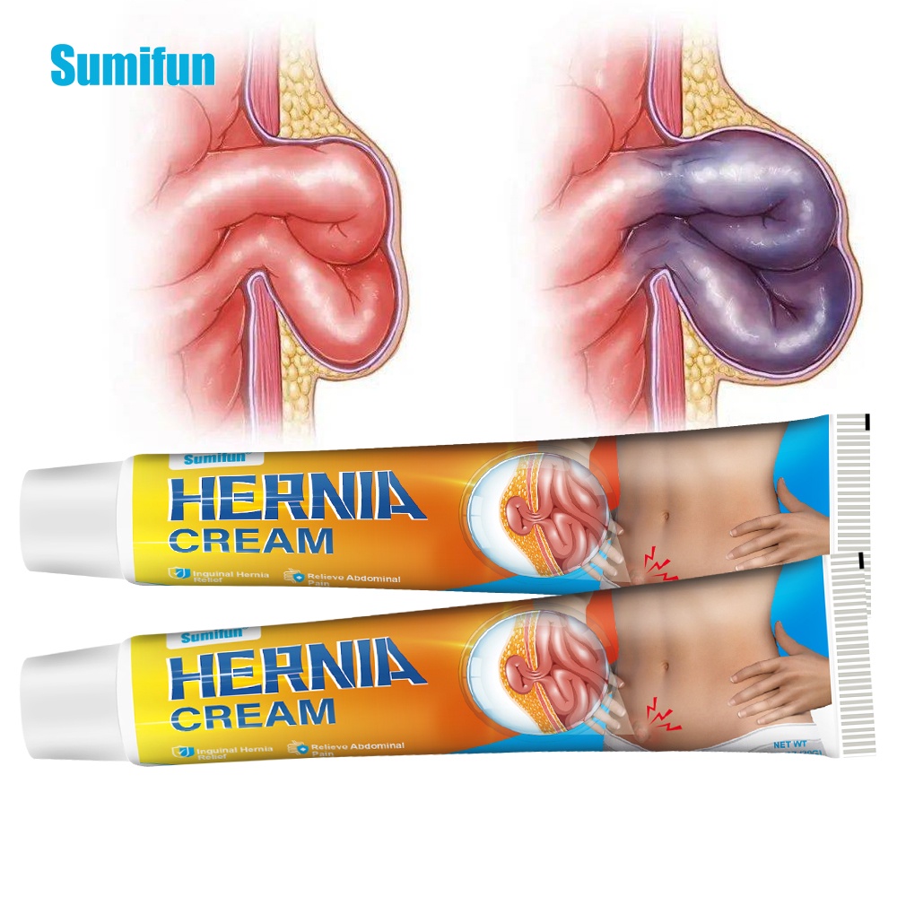 Sumifun 20G Hernia Treatment Cream Remove Umbilical Femoral Inguinal Tumor Ointment Tubercle Anti