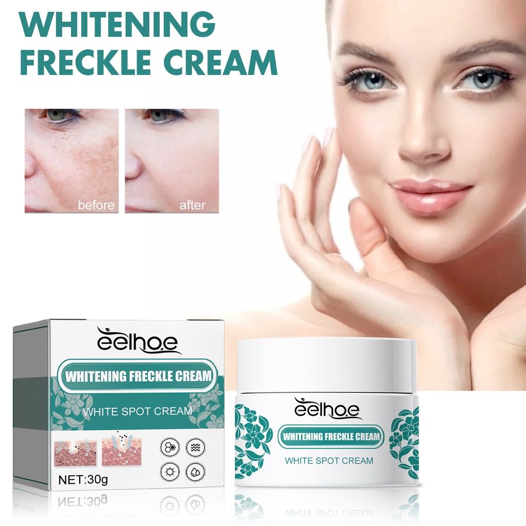 NEW NIACINAMIDE WHITENING FRECKLES CREAM REDUCE MELASMA MELANIN BRIGHTEN CREAM LIGHTEN DARK SKIN