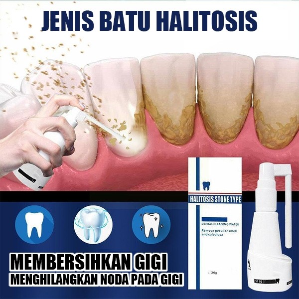 Perontok karang gigi paling ampuh Pasta gigi pemutih Perontok karang gigi 30ml Pembersih karang gigi