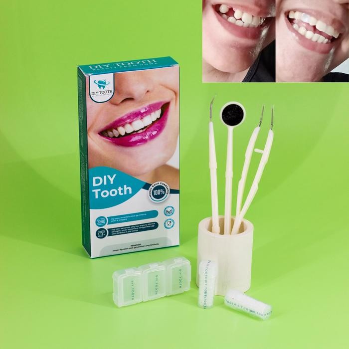 Diy Tooth Set Lengkap Gigi Palsu Bikin Sendiri Sementara -Gratisongkir