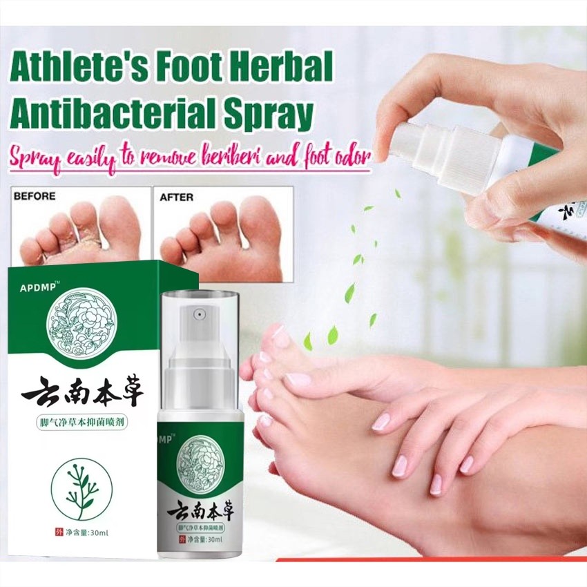 MD Penghilang Bau Kaki Semprotan Deodoran Kaki 30ML Semprotan Penghilang Bau Kaki Menghilangkan Bau