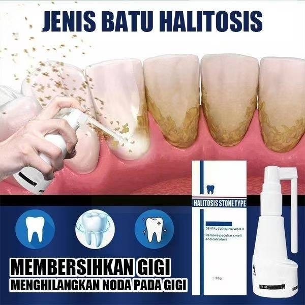 Gigi Penghilang Karang 30ml Pembersih Karang Gigi Membandel Alat Pembersih Karang Gigi Pemutih Gigi