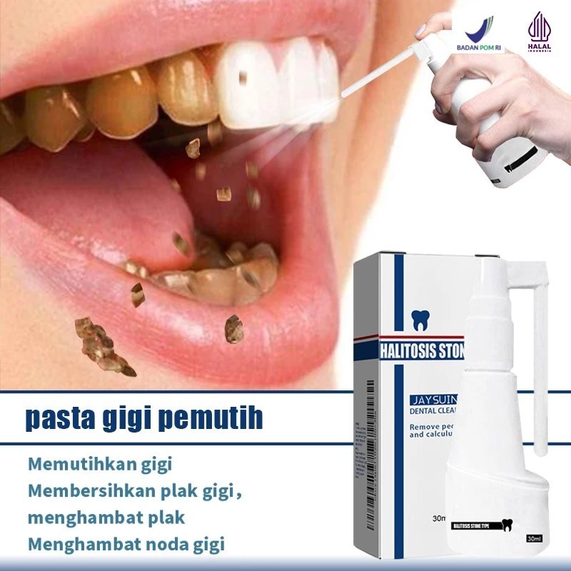 Perontok karang gigi paling ampuh Pembersih karang gigi Penghilang karang gigi 30ml Perontok karang