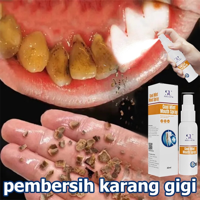 Pembersih gigi kuning dan karang perontok karang gigi paling ampuh pembersih gigi kuning dan karang