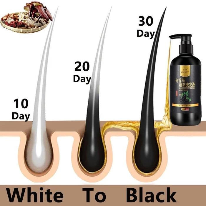 SHAMPO PENGHITAM RAMBUT UBAN MENJADI HITAM PERMANEN SAMPO 300ML PENGHITAM RAMBUT BERUBAN PERMANEN