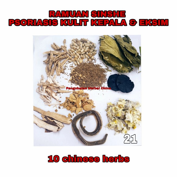 Sale Ramuan Sinshe Obat Cina Psoriasis Kulit Kepala Dan Obat Eksim
