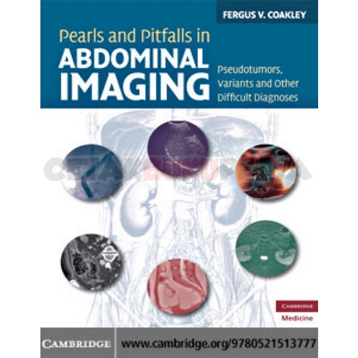 Book In Abdominal Imaging Pearls Pitfalls Softcover