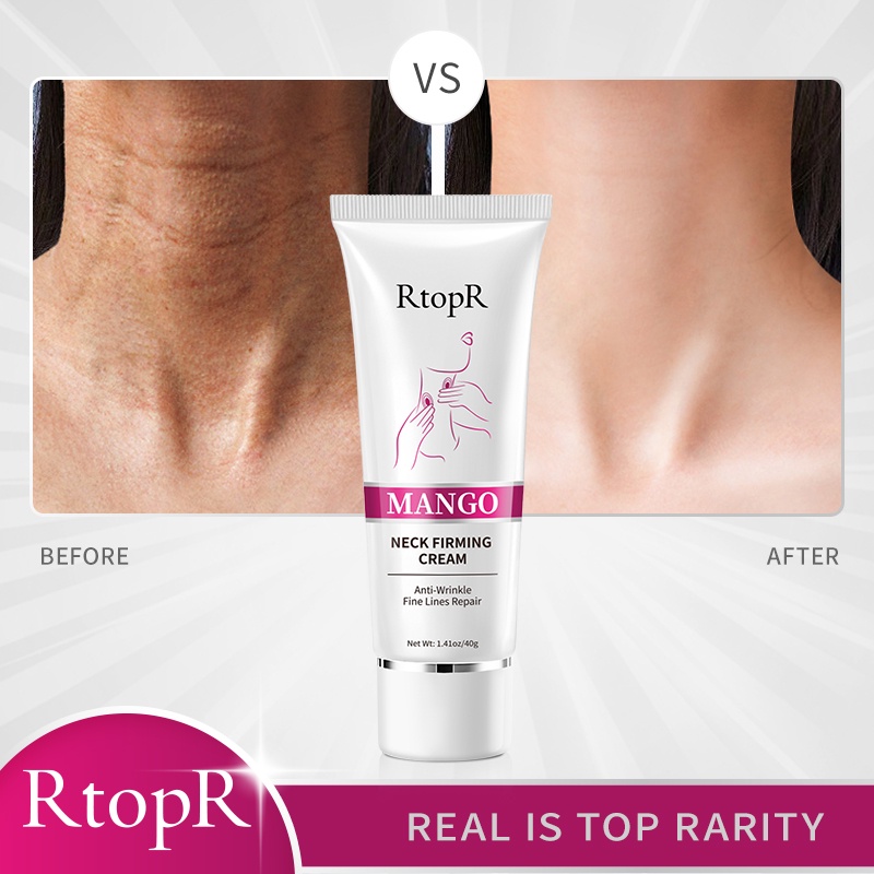 Rtopr Mango Neck Firming Cream Anti-Wrinkle Fine Line Repair Neck Cream Mild Whitening Moisturizing