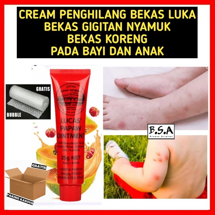 CREAM PENGHILANG BEKAS LUKA BEKAS GIGITAN NYAMUK PADA BAYI DAN ANAK