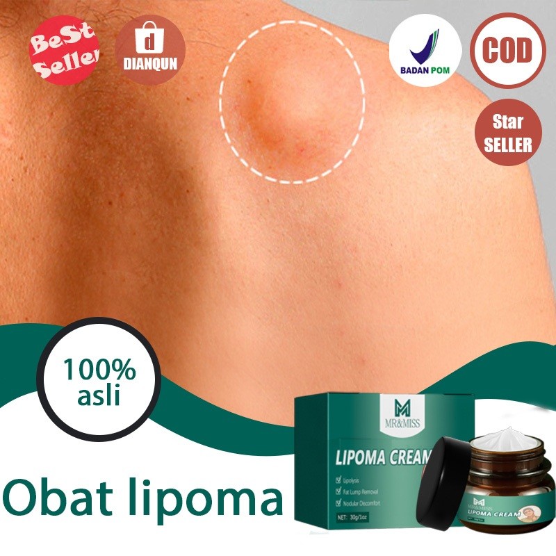 Lipoma cream salep benjolan salep lipoma salep benjolan obat benjolan 30g Lipoma cream original
