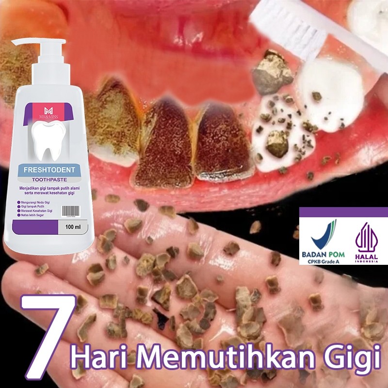 Odol pemutih gigi dan karang gigi pembersih gigi kuning dan karang perontok karang gigi paling ampuh