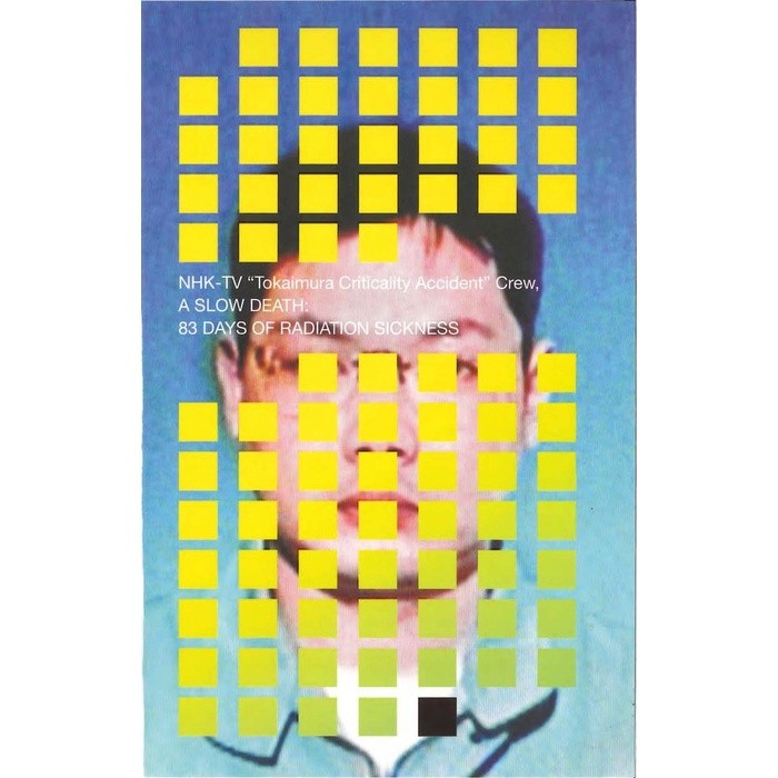 Produk Pilihan - (ARJ) - Versi Eng/Ind -NHK TV Crew - A Slow Death_ 83 Days of Radiation Sickness-Ve