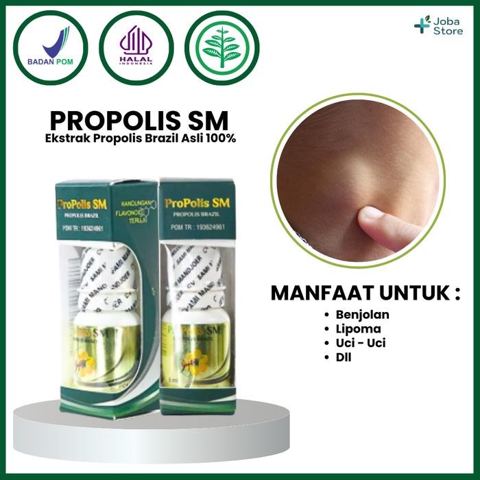 Penghancur Lipoma Uci Uci Benjolan Herbal Oles Propolis SM