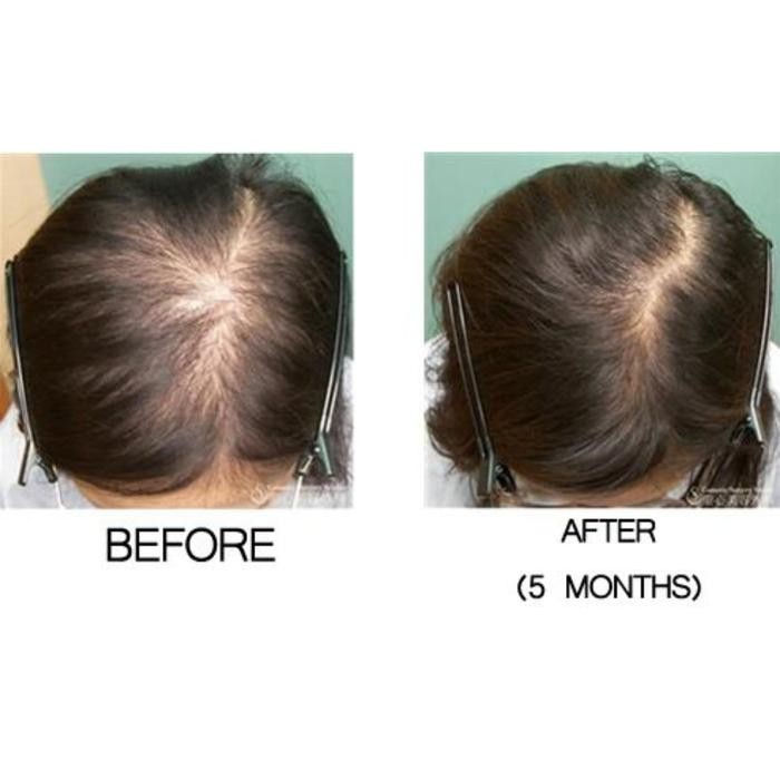 AQ SKIN SOLUTIONS SOLUTION HAIR COMPLEX 6ML GROWTH FACTOR SERUM RAMBUT