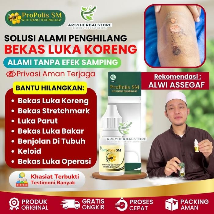 Propolis SM Herbal Oles Penghilang Bekas Luka Koreng Di Kaki, Bekas Korengan, Stretchmark