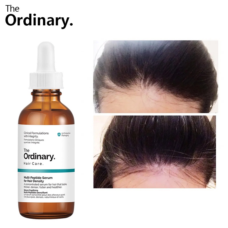 The Ordinary Multi-Peptide Serum for Hair Density Hair Growth Serum Penumbuh Rambut Botak dan Rontok-60ml