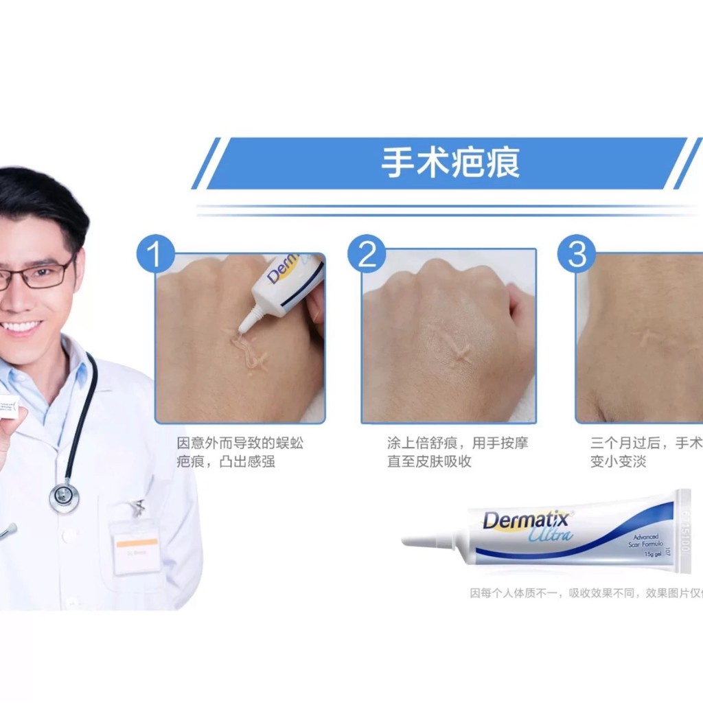 [ Dermatix Ultra ] Cream Penghilang Bekas Luka Operasi Iris Tergores Digigit Serangga Nyamuk / Luka Lama / Bakar / Gatal Hitam Koreng Di Kaki Oprasi Ampuh Advanced Scar Formula Gel Krim Wajah Keloid Stretchmark stretch mark Dermatik