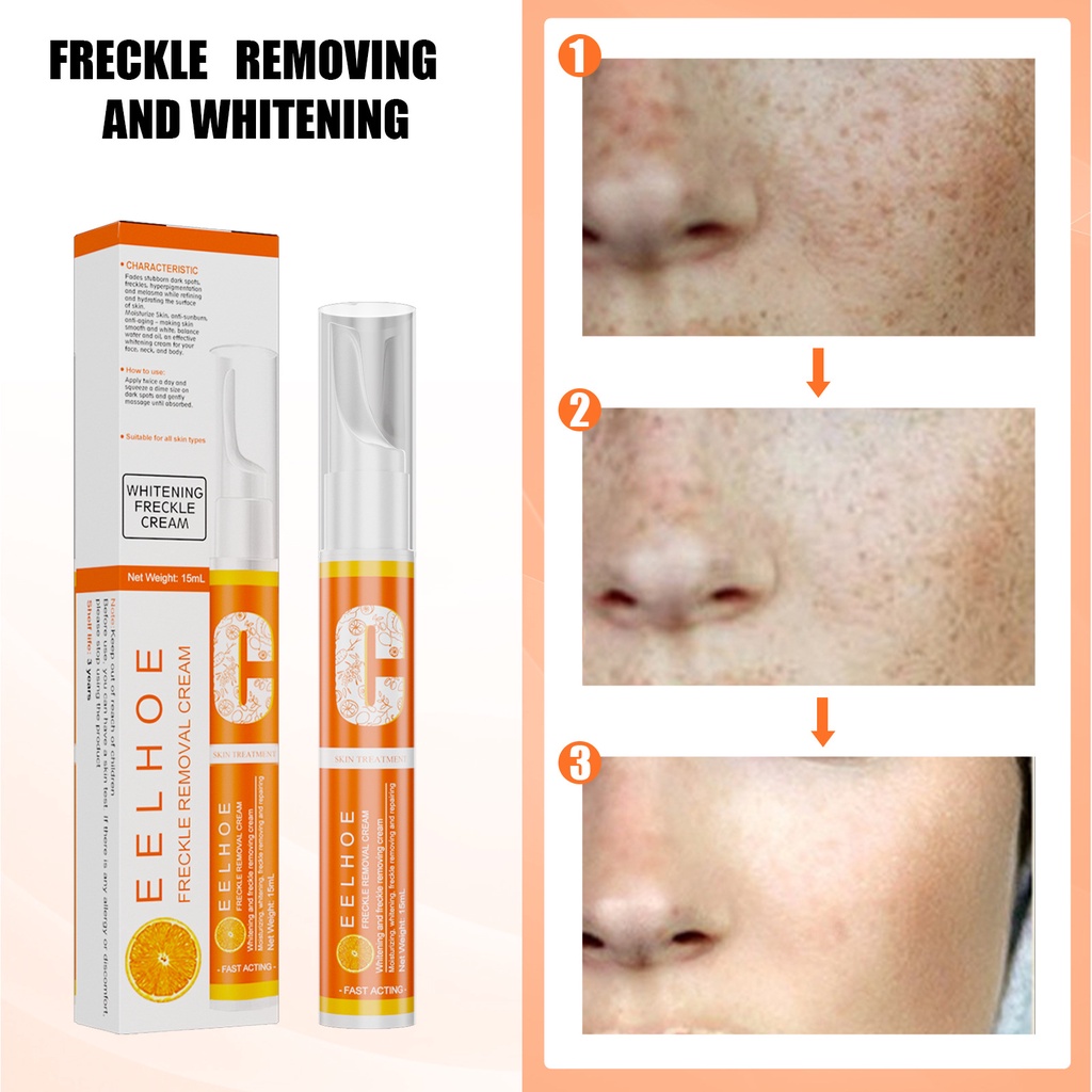 EELHOE Pibamy Pen Penghilang Melasma Pena Penghapus Flek Hitam Vitamin C Pen Penghilang Wajah Pemutih Mencerahkan kulit Flek Hitam Acne Removal Cream