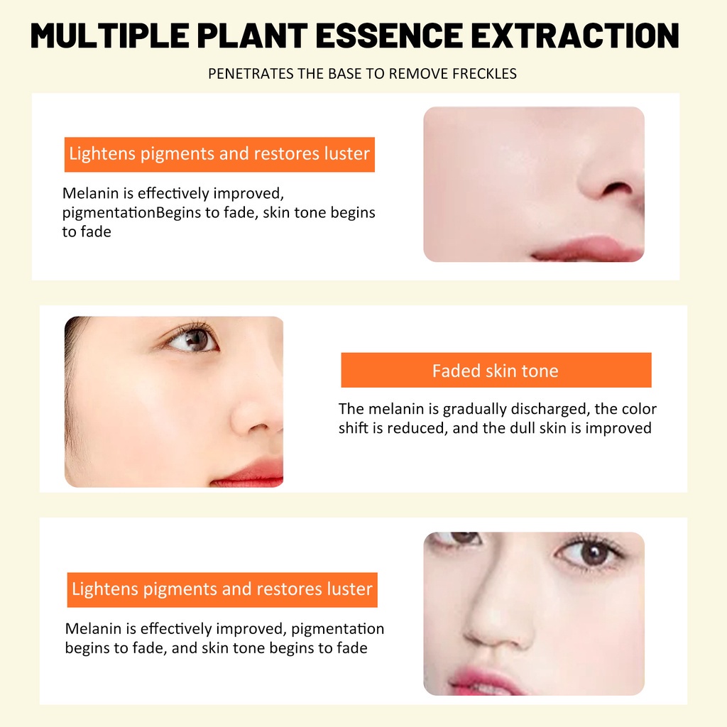EELHOE Vitamin C Whitening Freckle Cream Remove Dark Spots Untuk Pelembab Wajah Pemutih Mencerahkan kulit Flek Hitam Bintik Hitam