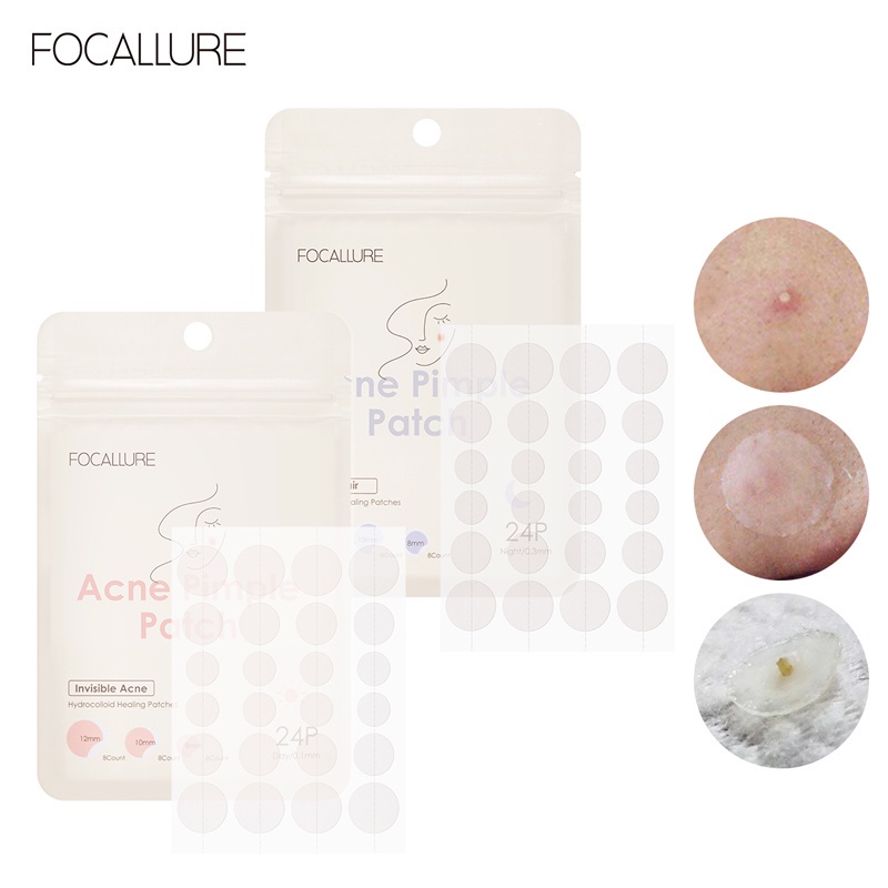 FOCALLURE Day/Night Waterproof Acne Patch Hydrocolloid Transparent Covers Acne Sterilize Acne Treatment