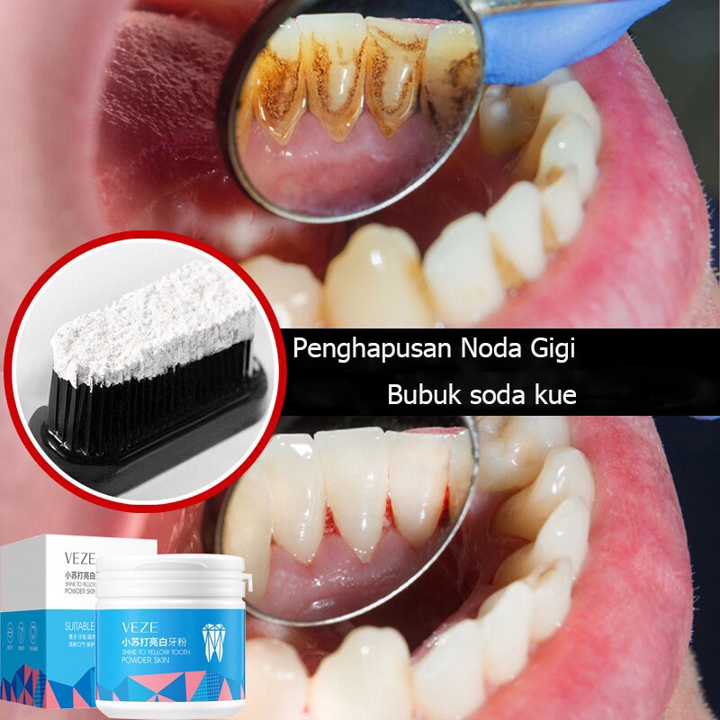 Pemutih gigi pembersih gigi kuning alat pemutih gigi 50g nafas segar  perawatan gusi  baking soda powder untuk menghilangkan gigi kuning dan memutihkan gigi