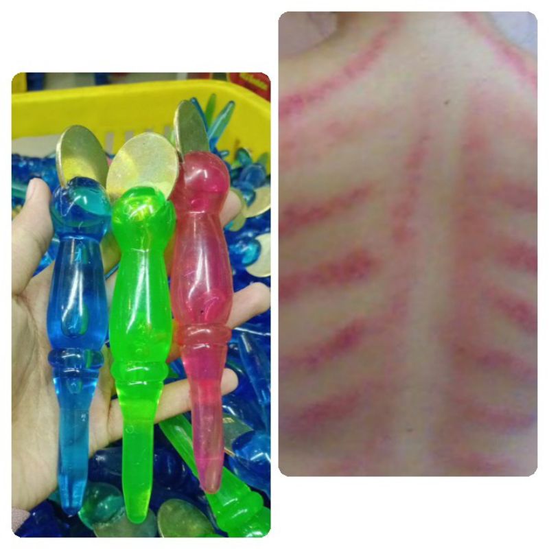 Alat kerokan koin Masuk angin