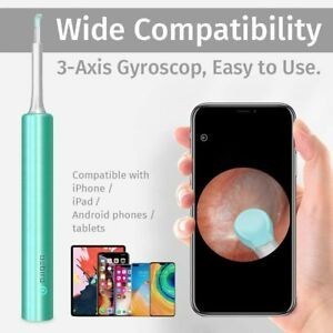 BEBIRD C3 Ear Cleaning WIFI Smart Visual Earpick - Korek Kuping