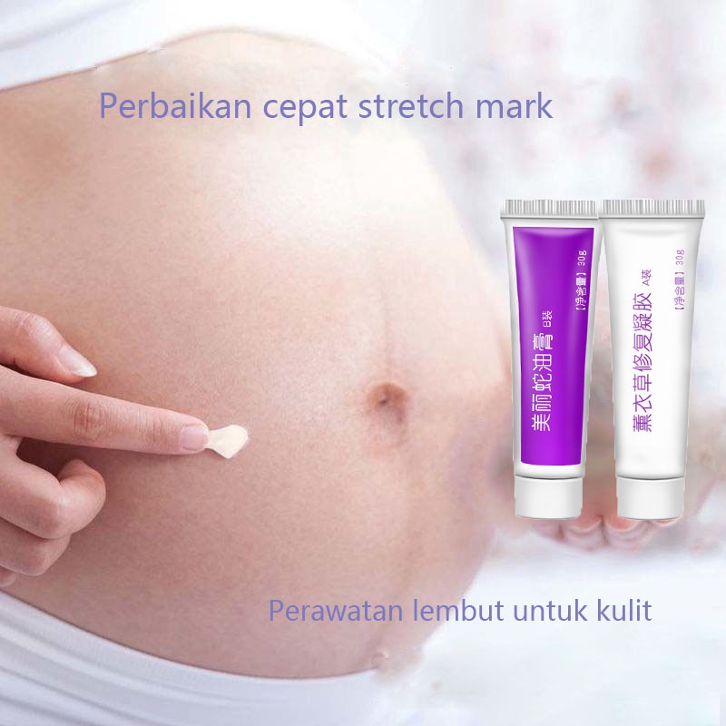 Krim penghilang bekas penghilang bekas luka penghilang bekas jerawat 60g Menghilangkan bekas luka dengan cepat dan lembut stretch mark bekas jerawat mengembalikan kulit halus