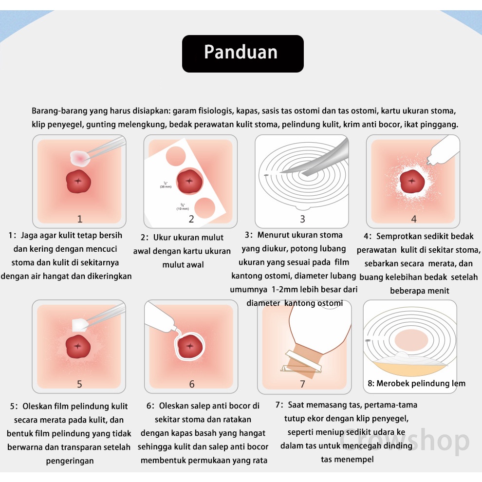 Colostomy Bag HDR Tas Ostomi, Kantong Kolostomi Satu Sistem Dapat Dicuci Penutup Krem Ukuran Potong 60/65Mm 10 Buah