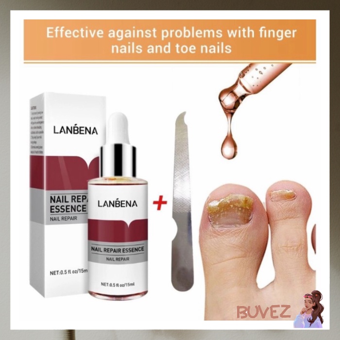 LANBENA NAIL REPAIR SERUM/ SERUM KUKU/ OBAT JAMUR KUKU NEWQUALITY