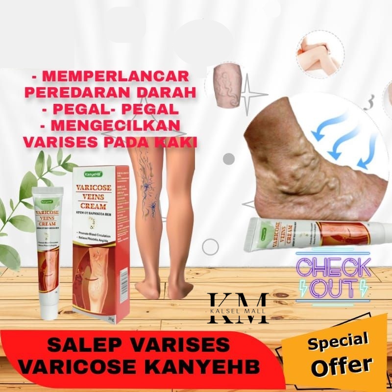 Obat Salep Krim Cream Varises Parises Farises Kanyehb ORIGINAL 100% Kaki Betis Kemaluan Testis Tangan Urat Membengkak Varicose Veins Paling Ampuh Ramuan Cina Herbal Tradisional OC11