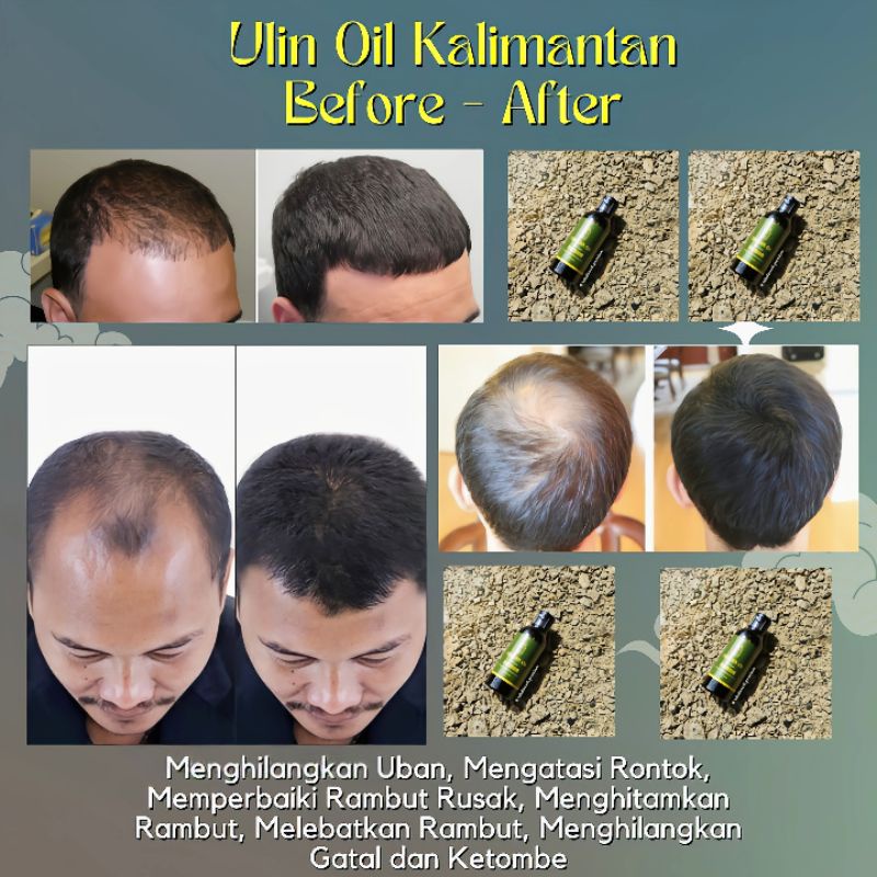 MINYAK UBAN KALIMANTAN SARI ULIN HAIR OIL PREMIUM HALAL 100% Original-2