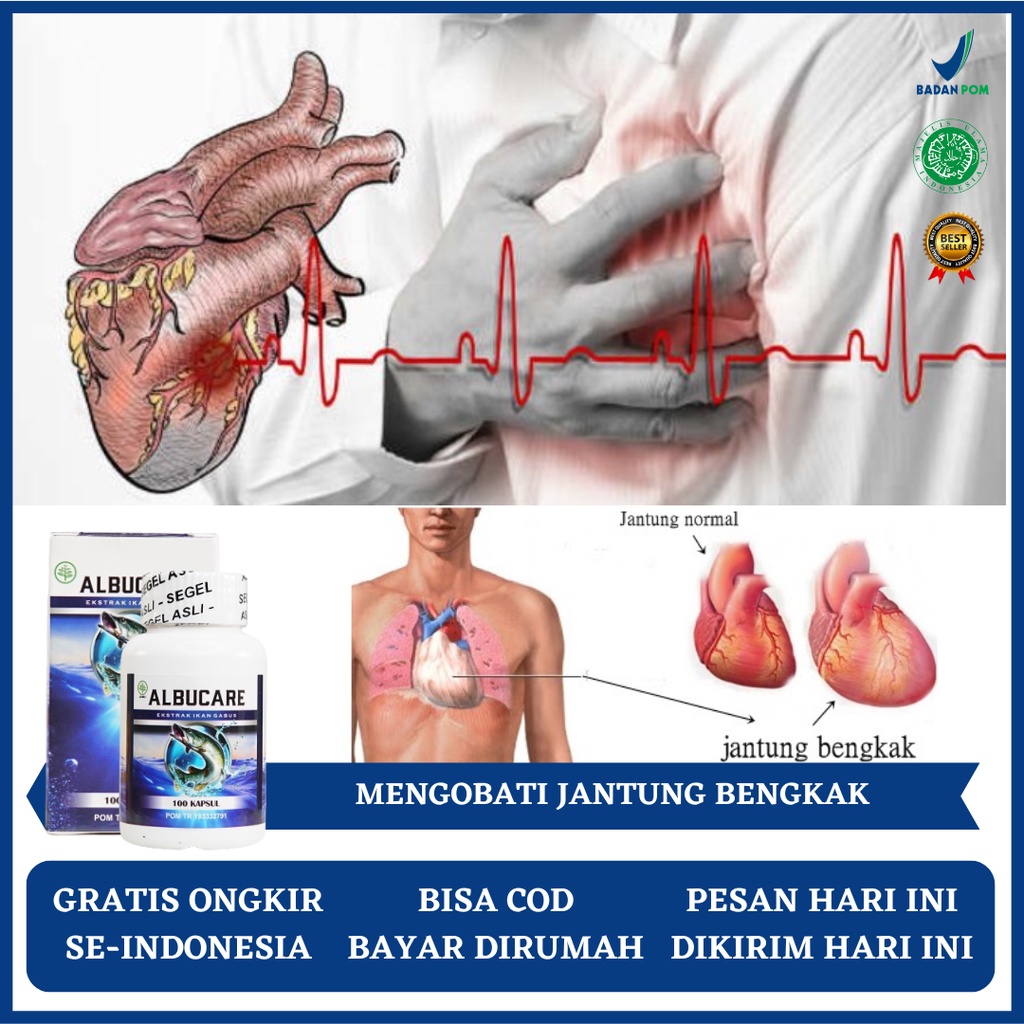 Obat Jantung, Obat Jantung Bengkak, Obat Jantung Bengkak dan Sesak Napas, Obat Jantung Membengkak, O