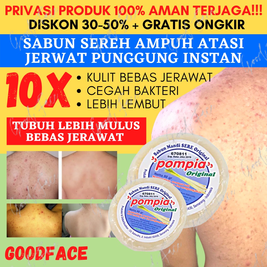 SABUN PENGHILANG JERAWAT PUNGGUNG-SABUN PENGHILANG DAKI-SABUN SEREH POMPIA ORIGINAL