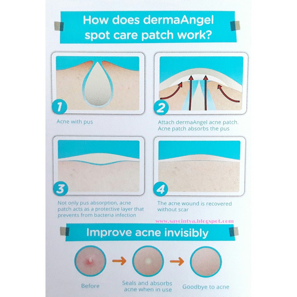 Derma Angel Acne Patch Plester Sticker Jerawat Transparan